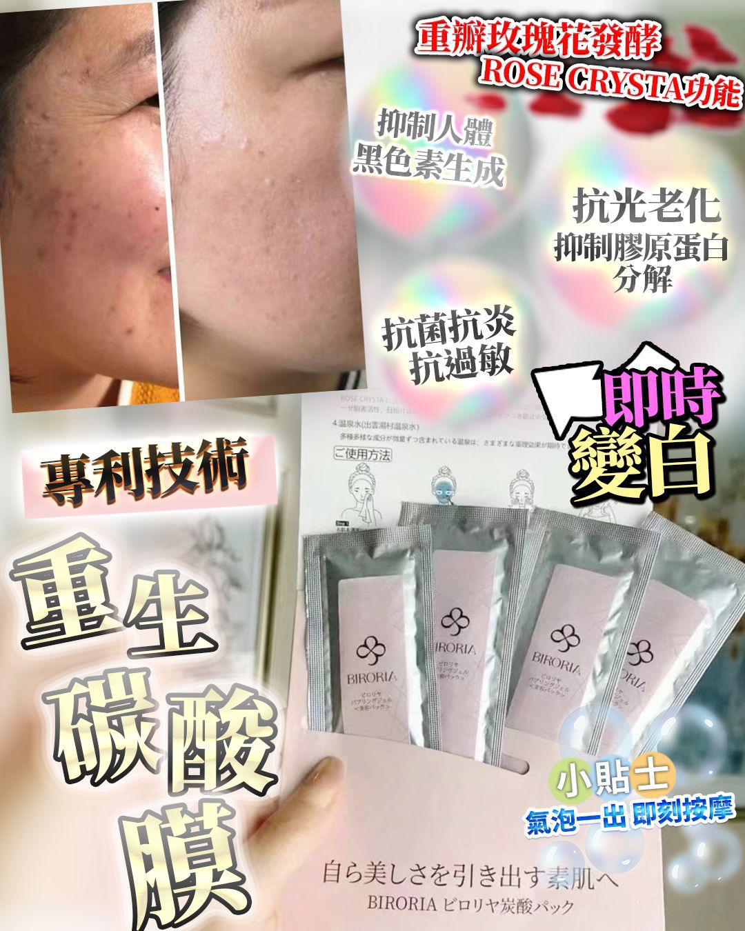 $190盒4入。2盒起$180盒。日本重生碳酸面膜 （1盒4次）
