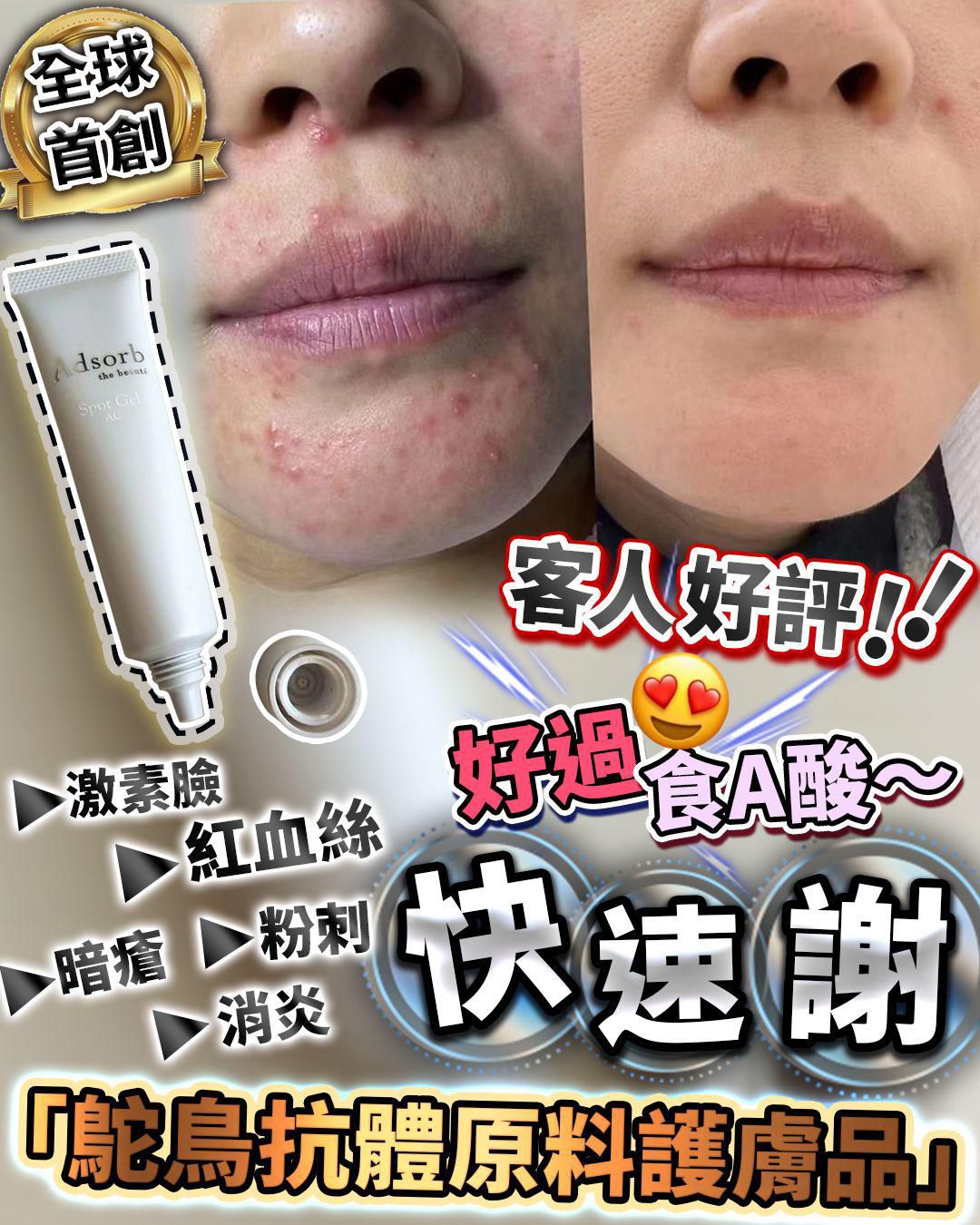$230支。日本暗瘡終結者