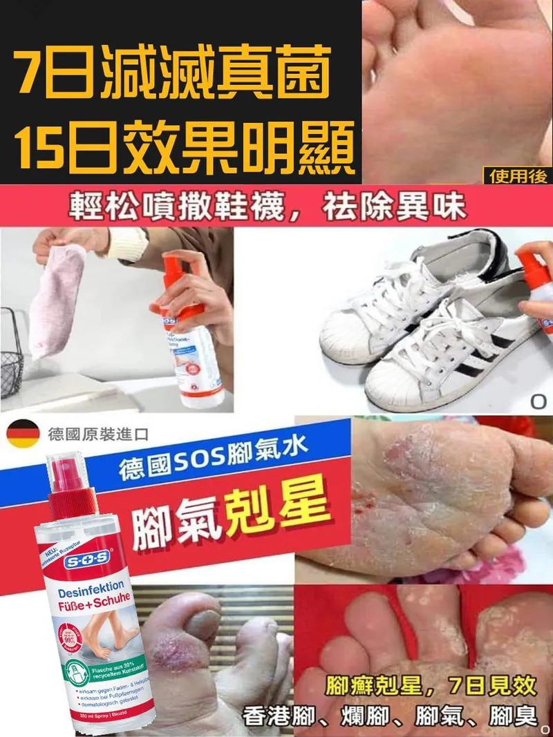 $79支.2支或以上:$69支.德国SOS脚气水250ml