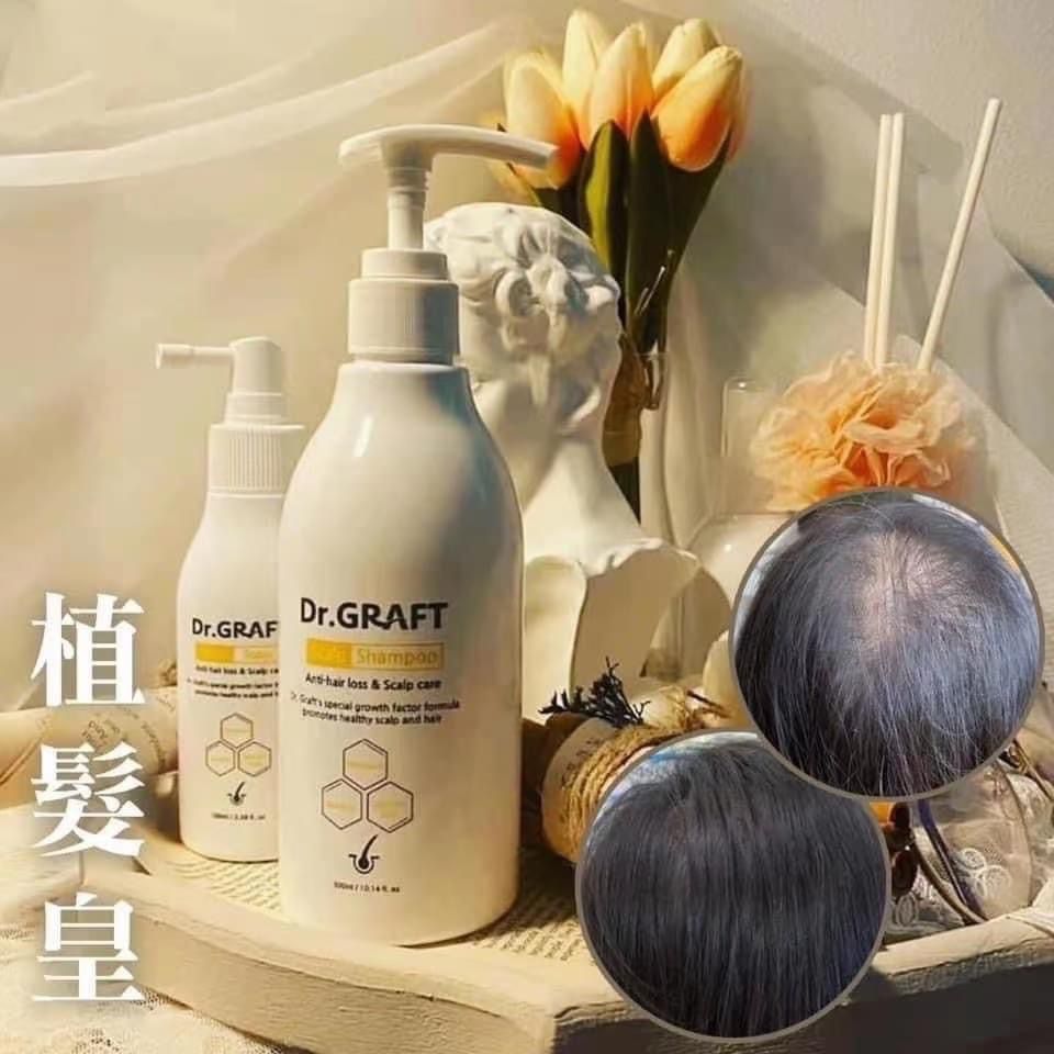 韓國🇰🇷Dr.GRAFT 植髮皇🇰🇷韓國No.1頭髮移值整形醫院建立品牌