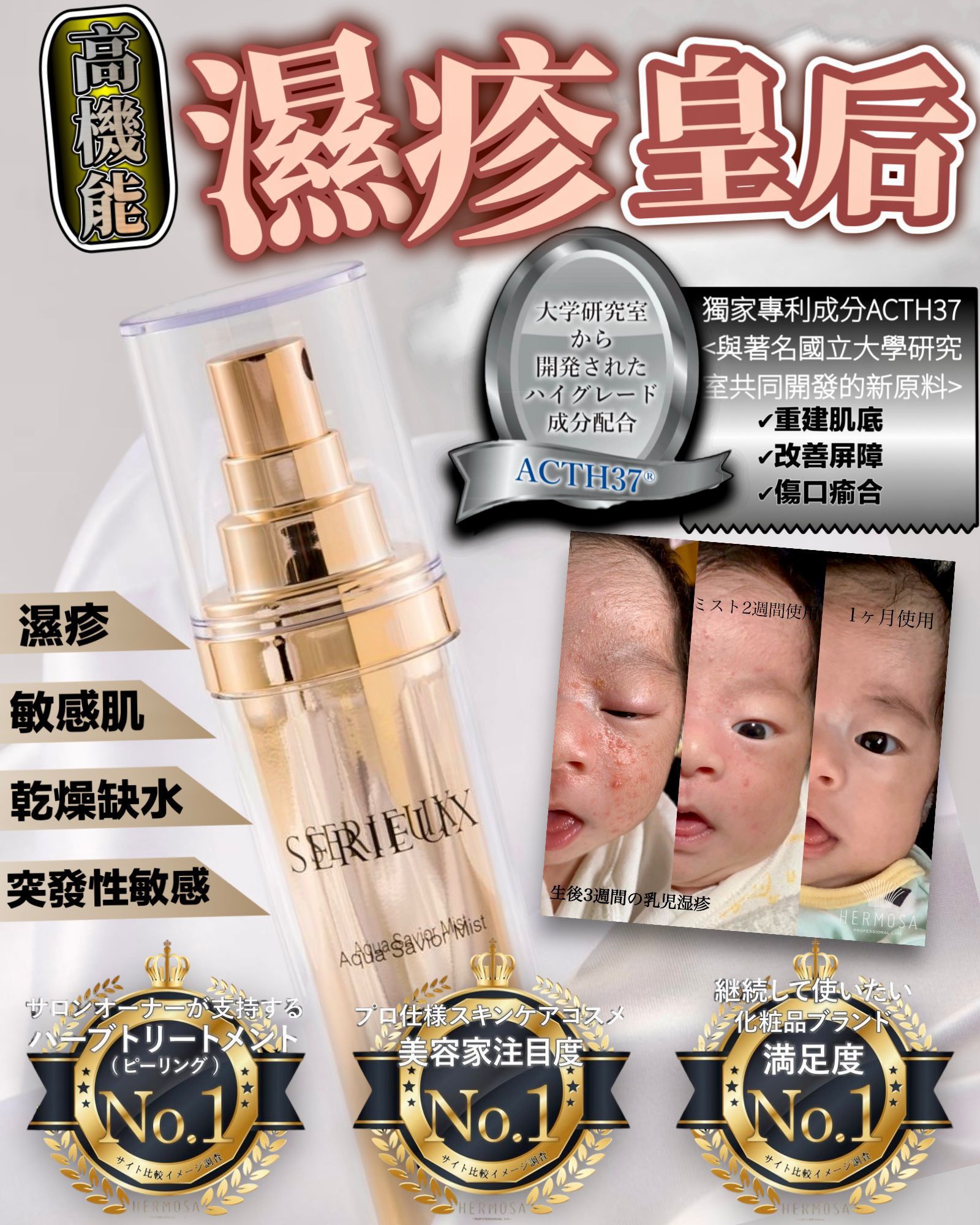 $310支。2支起$299支。濕疹皇后
