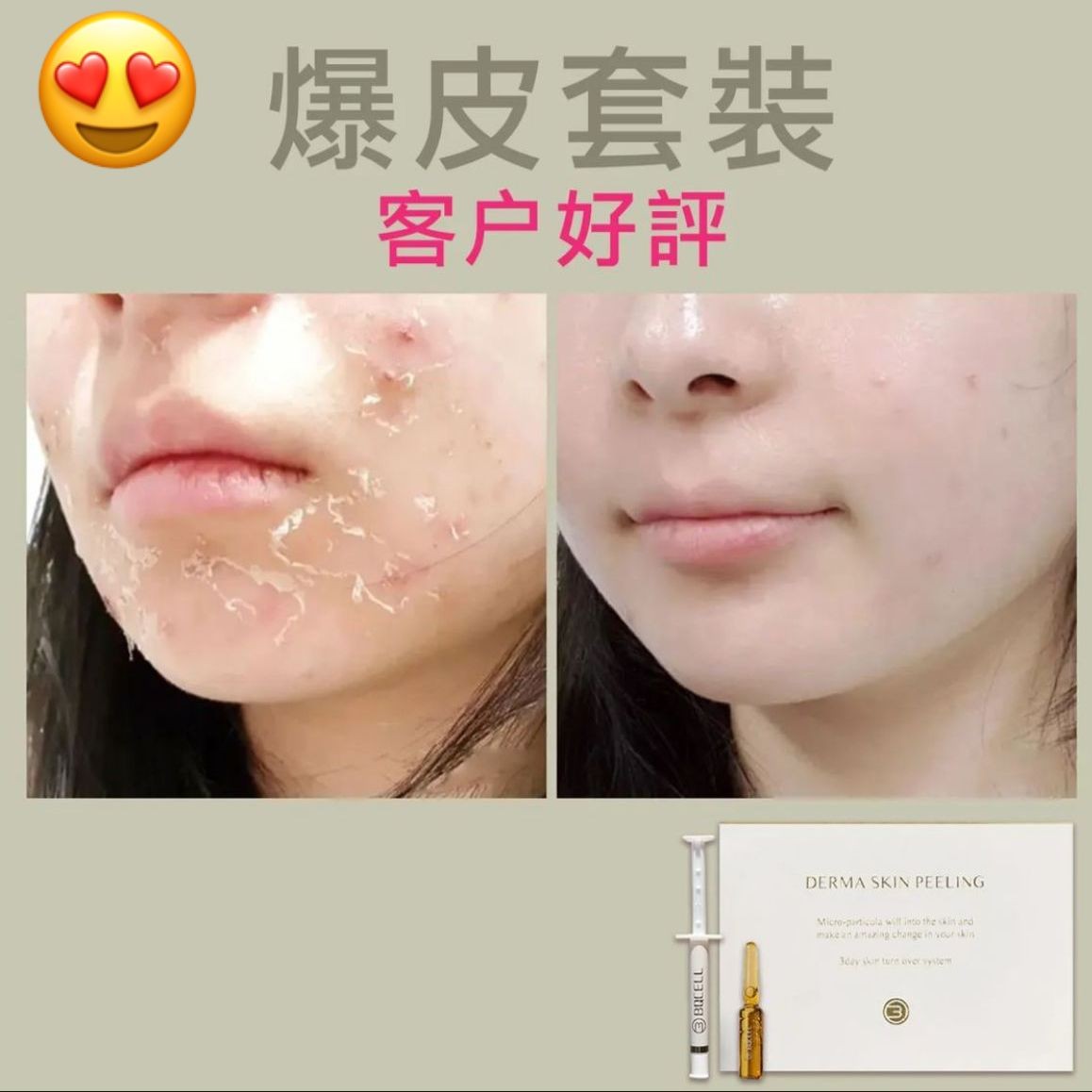 $32O套。5月中到WFH必備,72小時.皮膚重新勁到爆