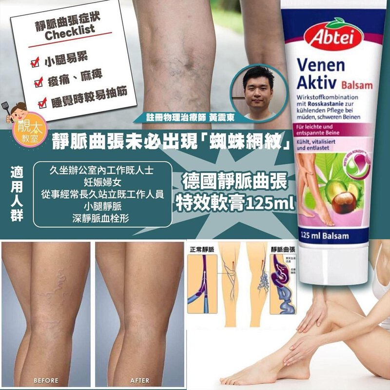 $65支。2支起$55支。德国静脈曲張特效软膏125ml
