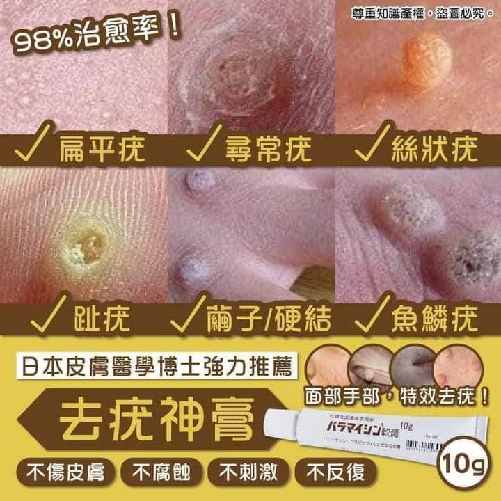 $35支。3支起$30支。1盒10支$180盒。🇯🇵日本皮膚醫學博士強力推薦 去疣神膏 10g💛