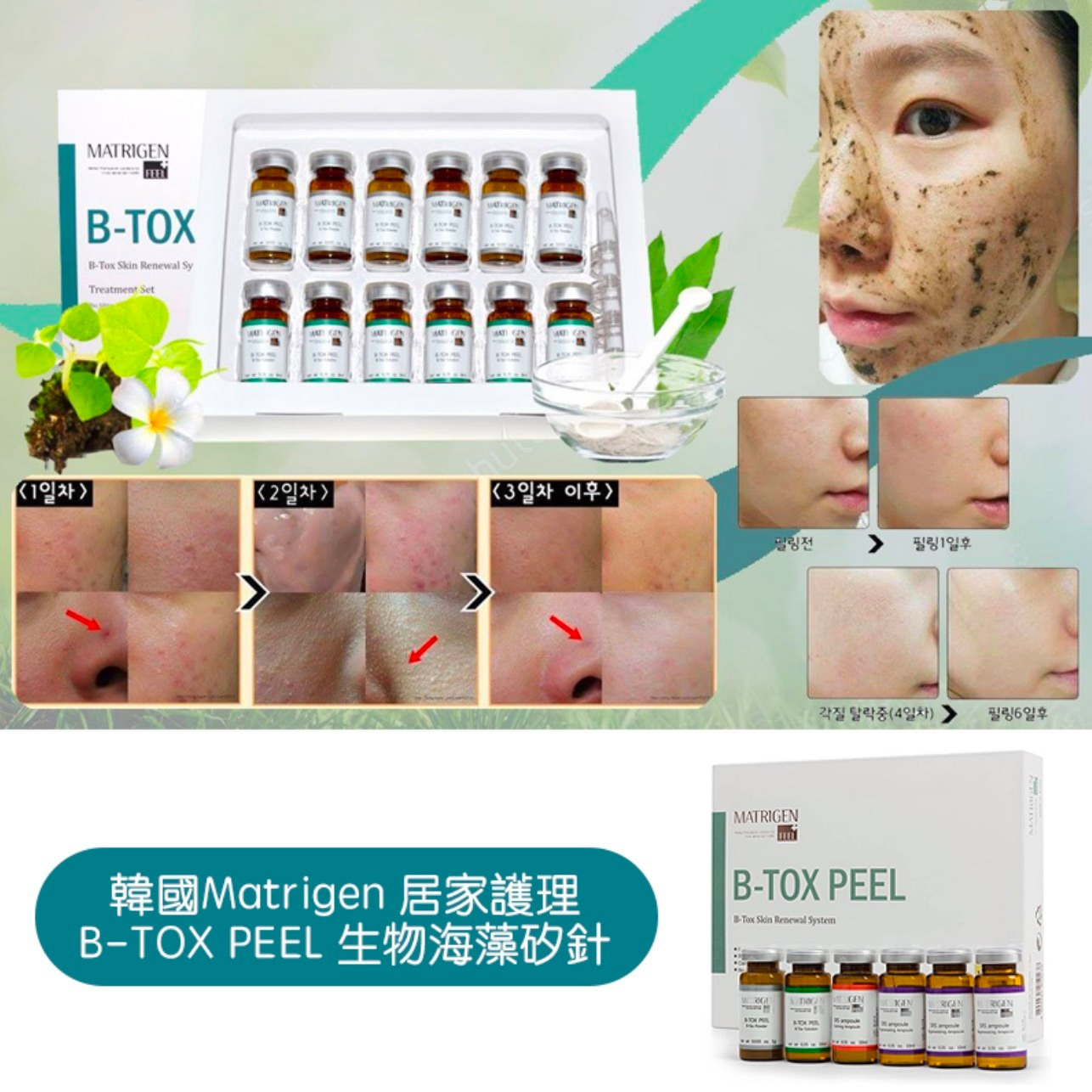 $188套。2套起$180套。韩国制 Matrigen B-Tox Peel 海藻矽针皮膚再生修復疗程。