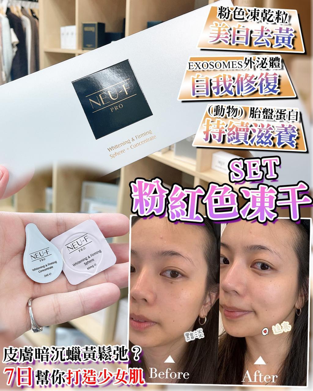 $299套。Neu-F Whitening/Firming Sphere+Concentrate粉紅色凍干set