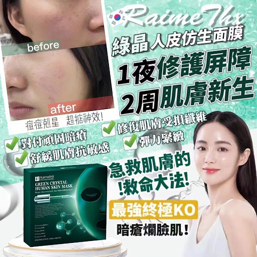 $140盒6片货期📦过年前激赞‼️爆全城🔥韩国抗敏针💉#疯狂急救𝐒𝐎𝐒🉐🉐