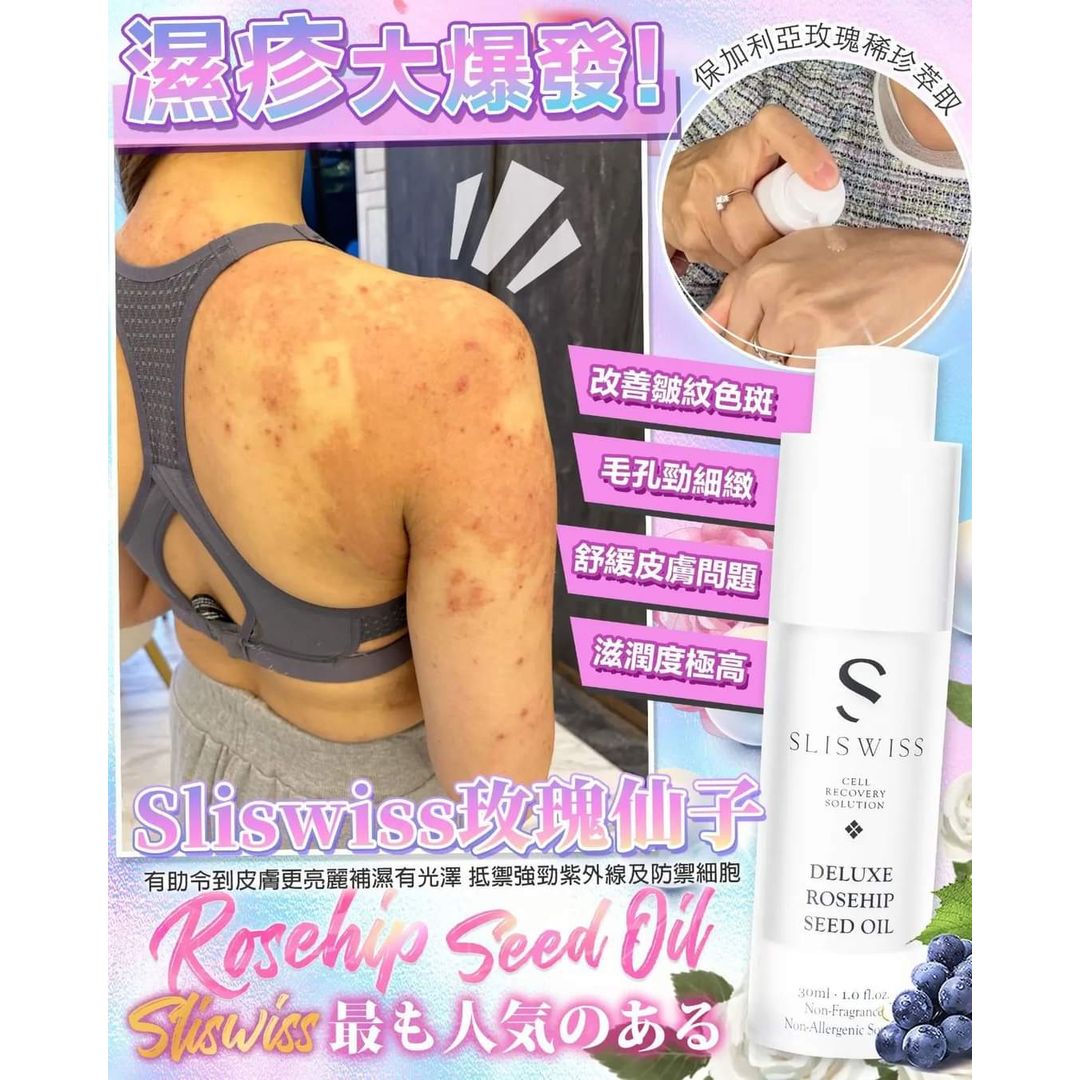 $265支。2支起$255支。Sliswiss 白藜蘆醇爆水玫瑰仙子❤️法國保加利亞玫瑰濕疹油❤️ 30ml