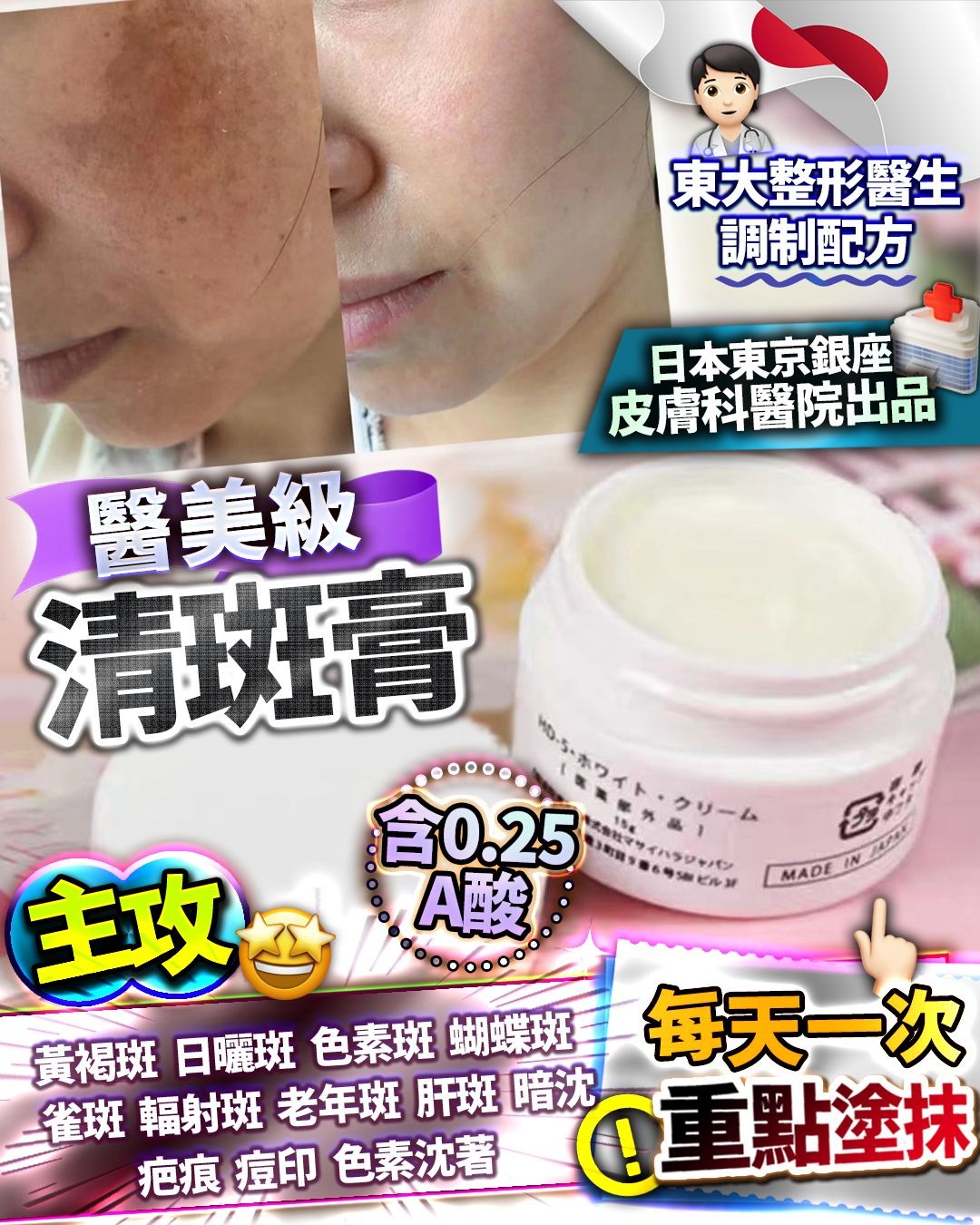 $168件。2件起$158件。日本清斑膏 15g 重点塗抹