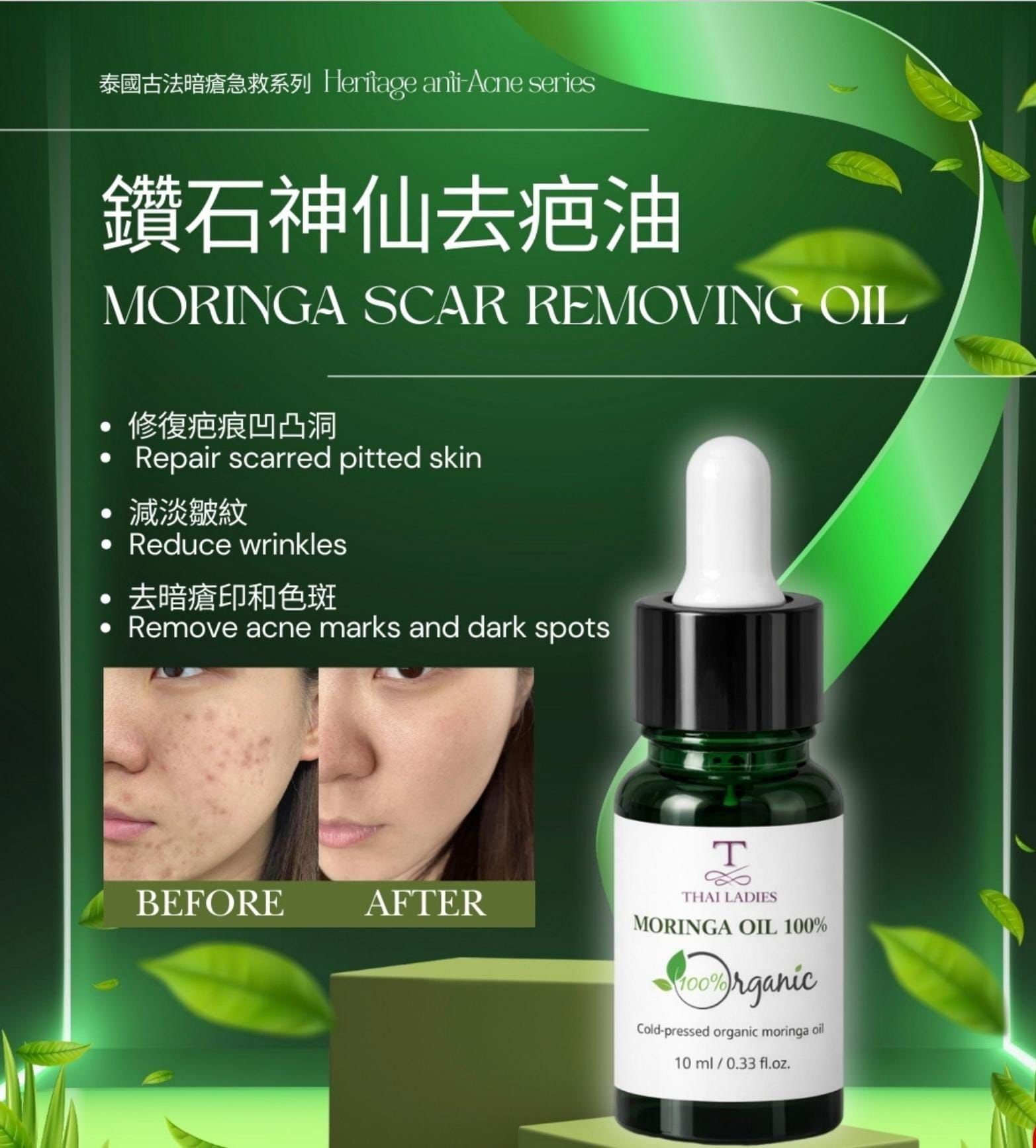 $198支。🌟 鑽石神仙去疤油採用100%天然成份