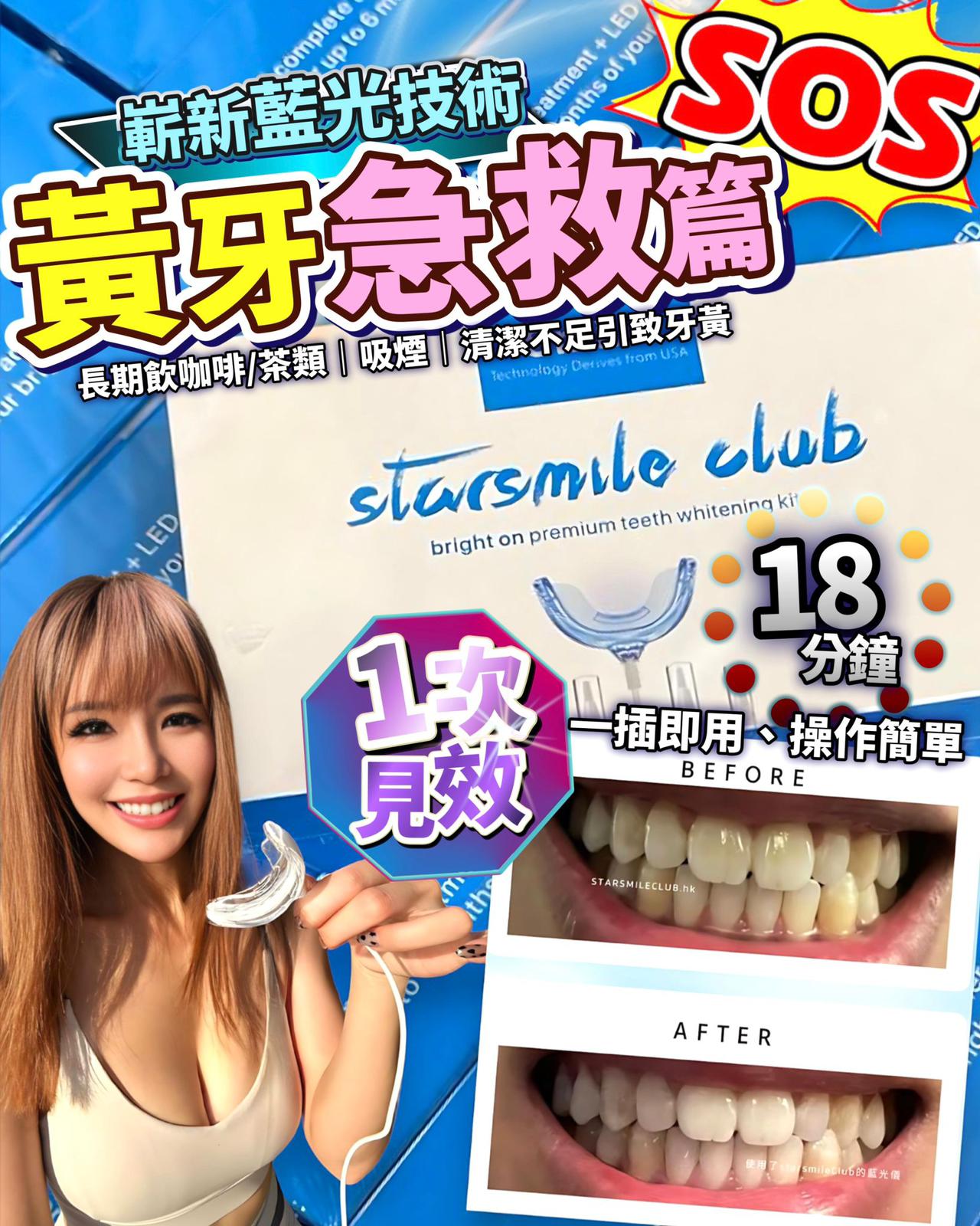 $210套。StarSmileClub美國🇺🇸藍光美白牙齒機
