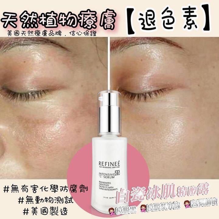 $258/1套 .3支「REFINEÉ 白瓷冰肌精醇露」係一支適合大家使用嘅美白精華💞