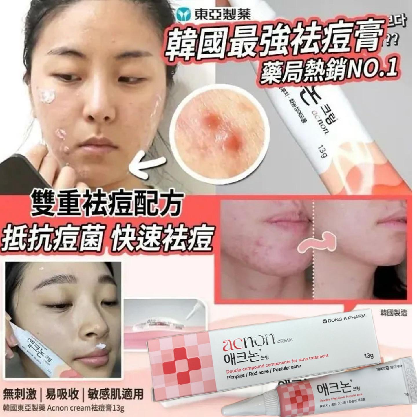 $132支。2支起$122支。🇰🇷 No scar 超強修復淡疤膏 去疤膏 除疤修復膏 韩国东亚 知名除疤软膏