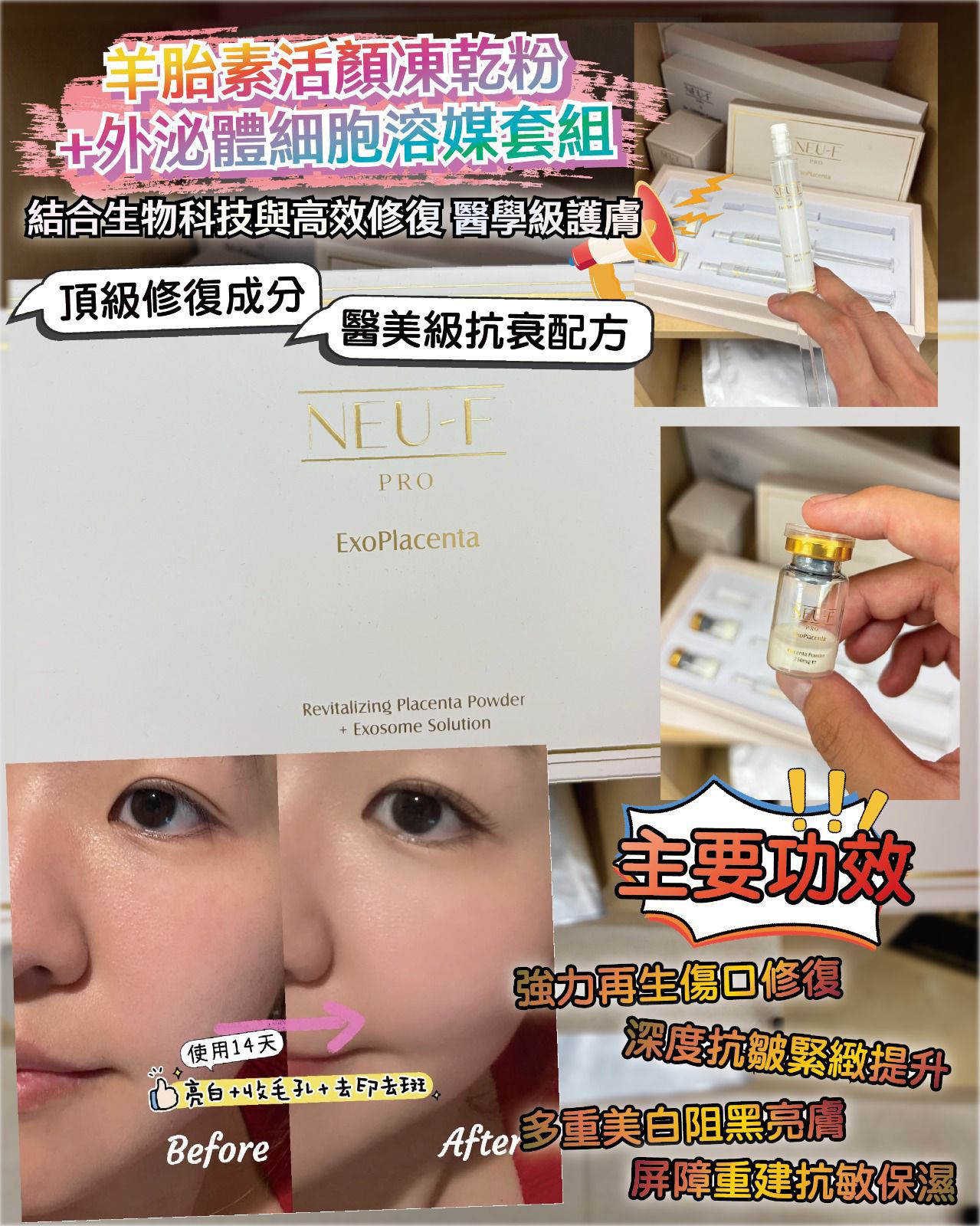 NEU F PRO ExoPlacenta营养针 $320盒。