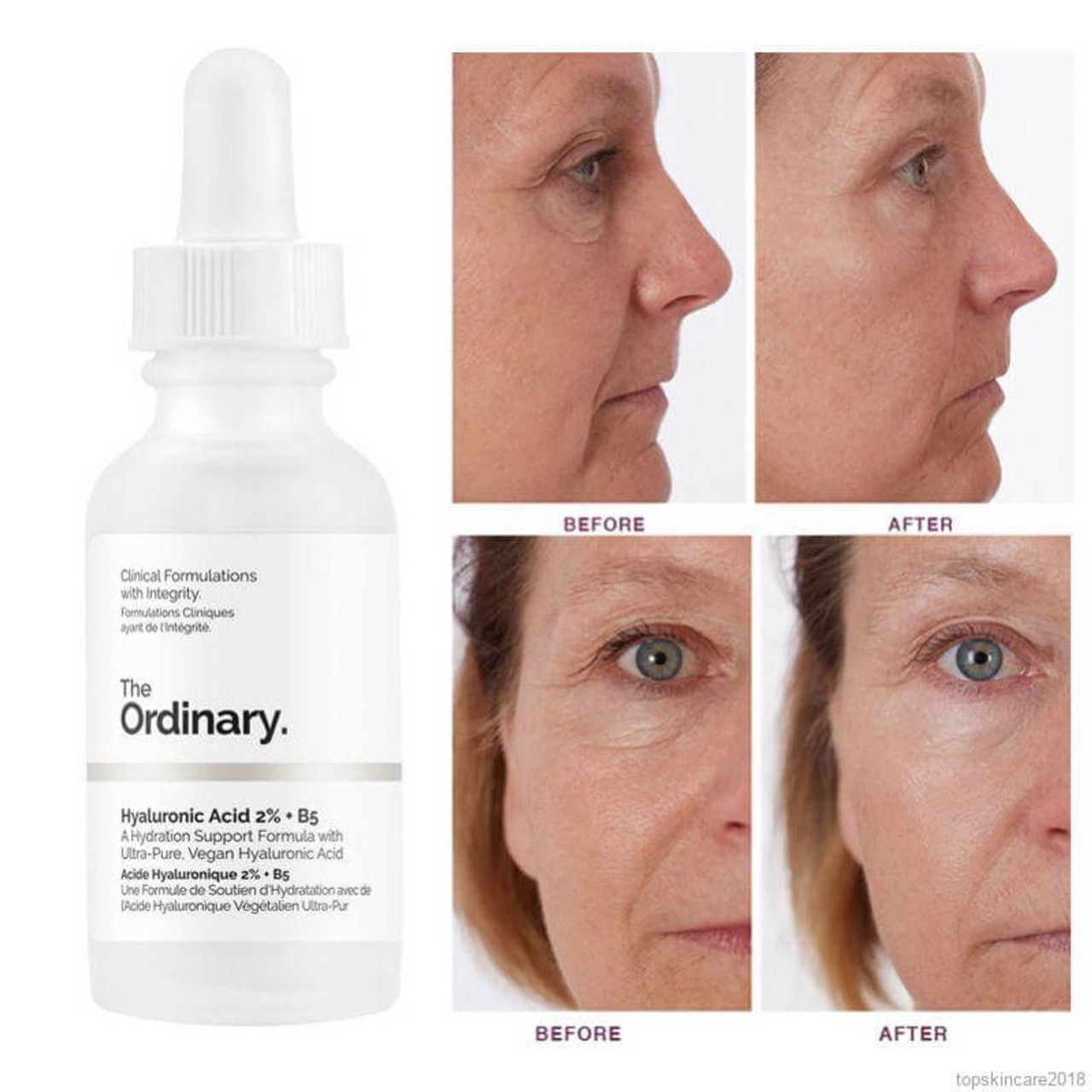$8O/1。2支起$70/1。The Ordinary | Hyaluronic Acid 2% + B5 30ml