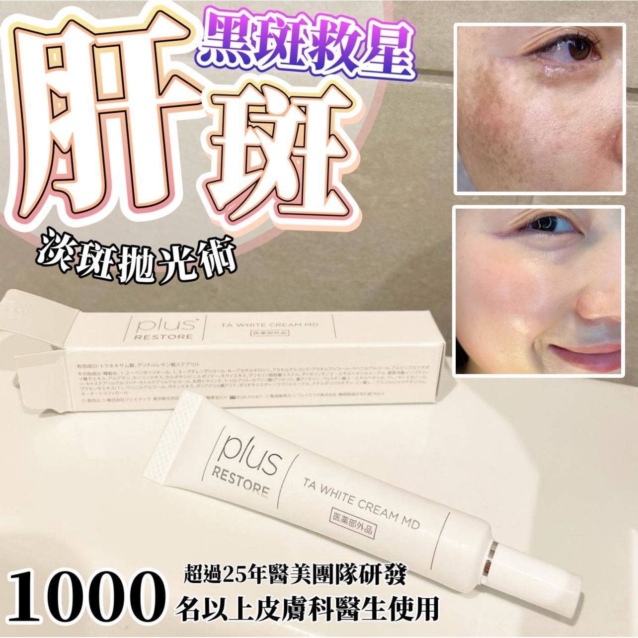 日本 醫療級 黑斑救星 10g$210支。2支起$195支現貨💕