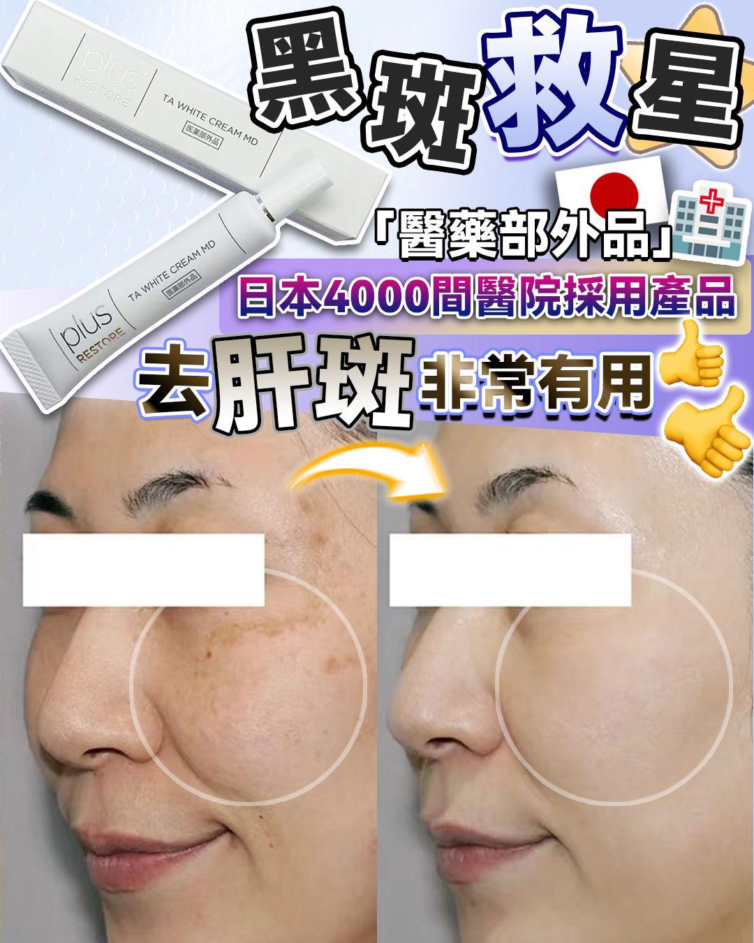 $210支。2支起$205支。日本 醫療級 黑斑救星 10g
