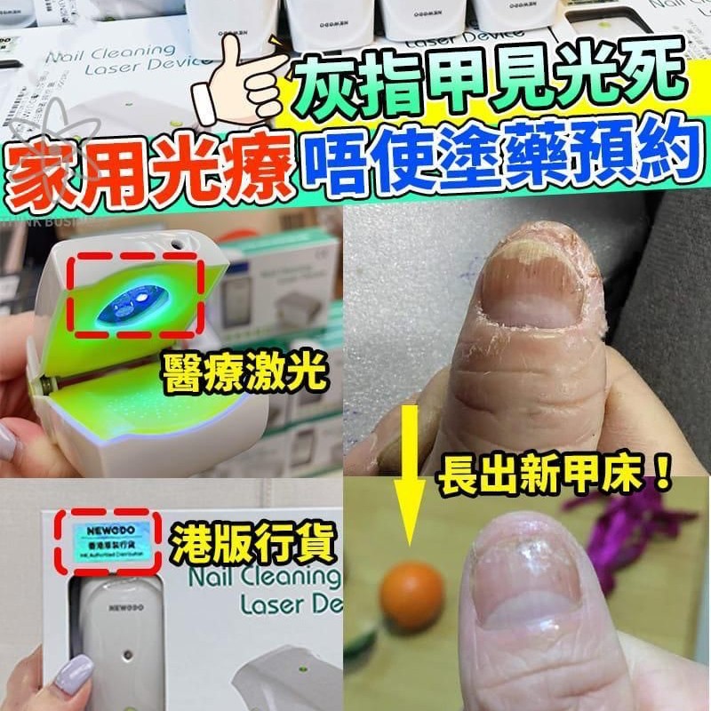 $598件。2件起$588件。美國NEWEDO擊退灰甲激光治療儀