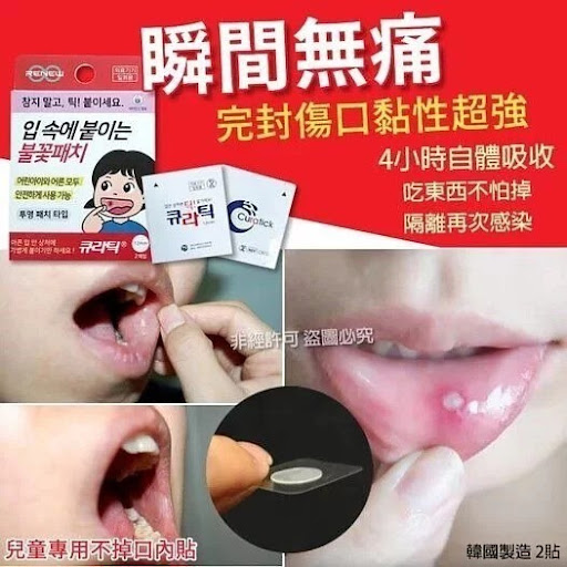 韓國製造瞬間不痛不掉口內貼-1套3盒$55/套2套起$48/套