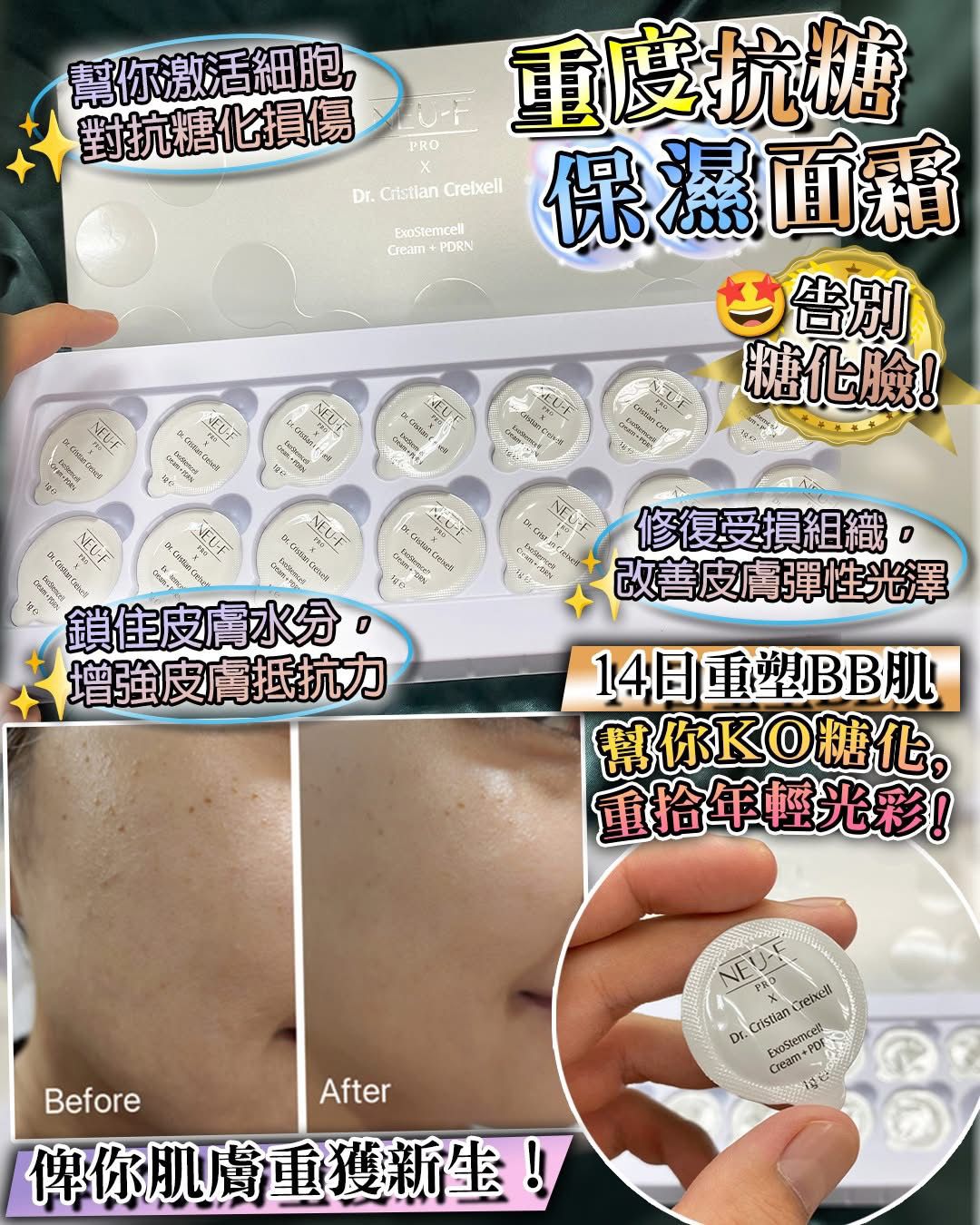 $330盒。2盒起$ 320盒。Neu-F ExoStemcell + PDRN Cream 強效抗糖保湿面霜 14 pcs